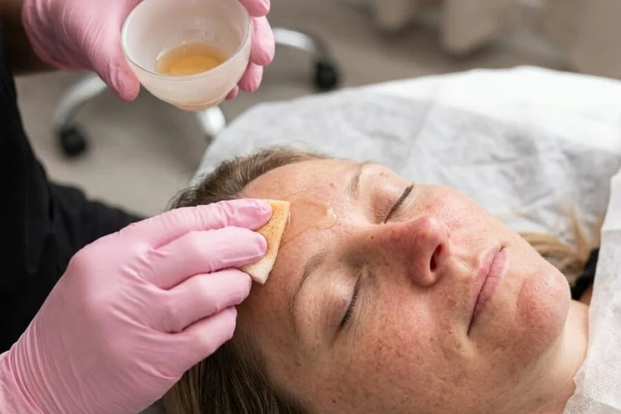 Clinician wearing pink gloves holding a small bowl of amber solution and applying it with a sponge to a reclined patient's forehead. Photo: Express Med Spa (expressmedspas.com).